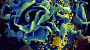 HIV diagnosis rate drops