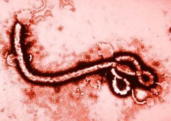 ebola-disease1