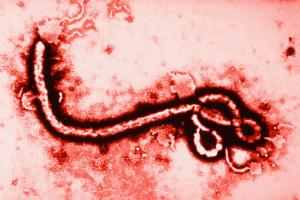 California Man Treated for Possible Ebola Exposure