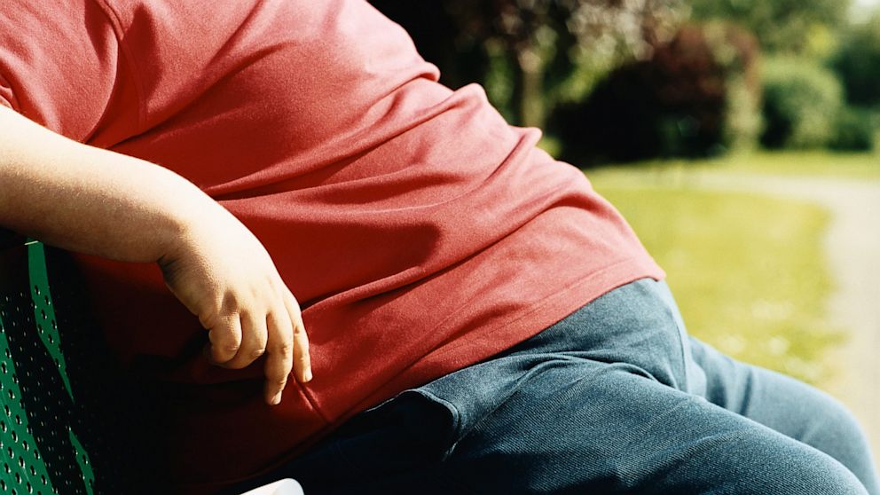 obesity-shortens-life-by-8-years