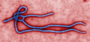 Ebola at the UC Davis Medical Center