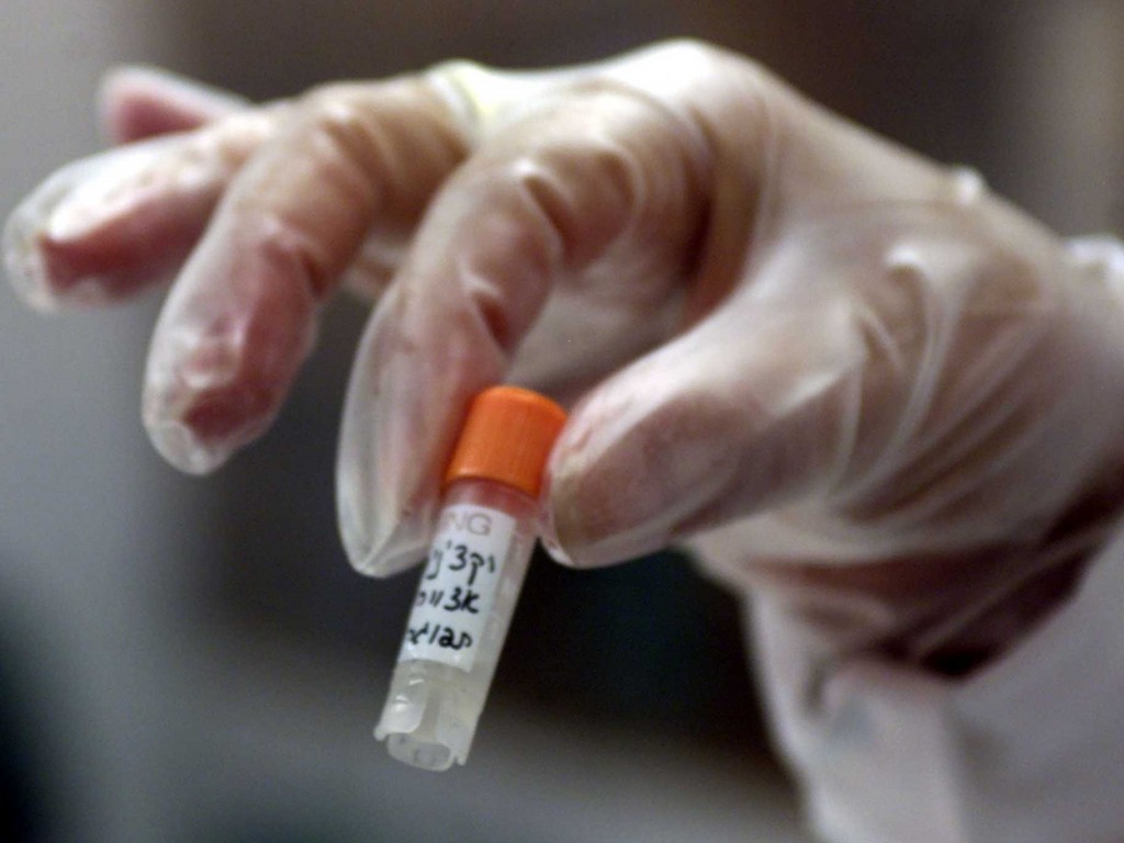 Clinical Trial For Ebola Medication ZMapp Starts In U.S. And Liberia