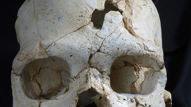 alt="scientists have studied the holes on the skull"