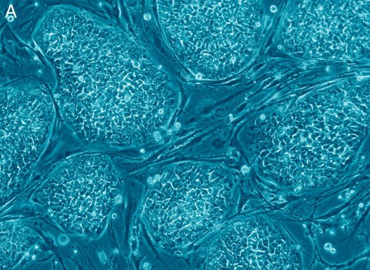 "New Stem Cells may Combat Mitochondrial Diseases"