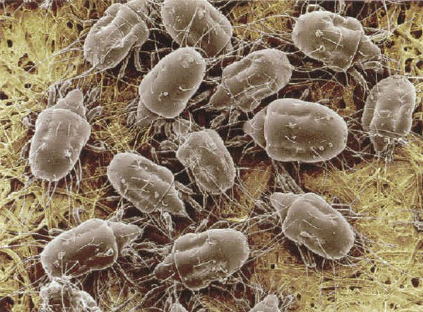 alt="house dust mites under microscope"