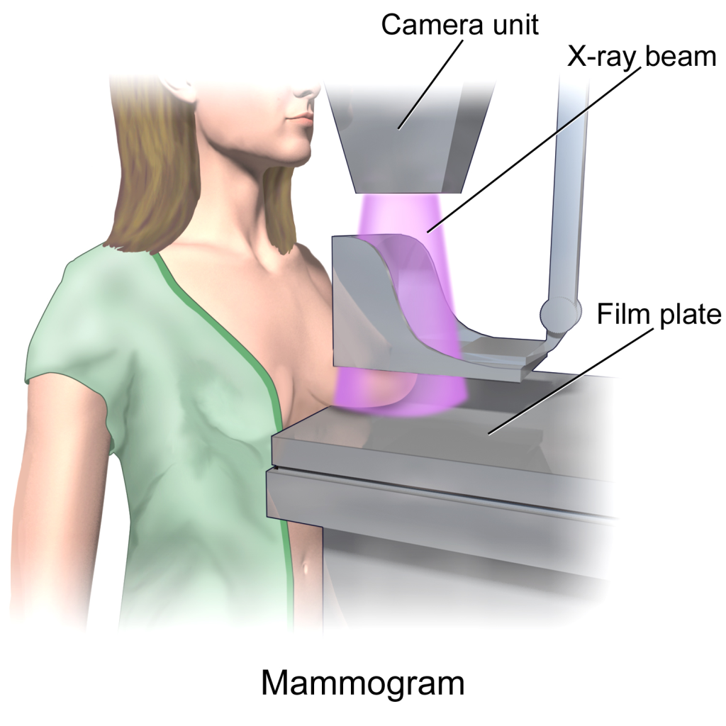 "mammography"