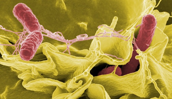 Salmonella pathogen under the microscope