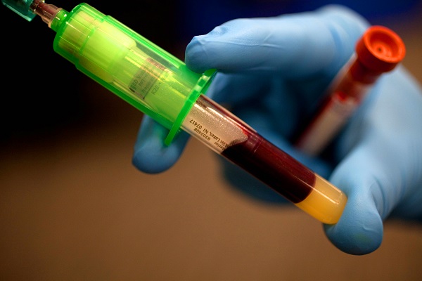 genetic blood tests syringe and recipient in hand