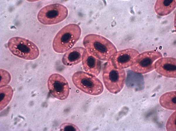 red cells for blood transfusions 